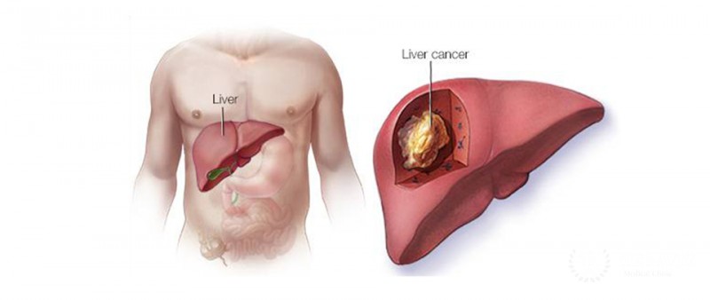 Liver formation