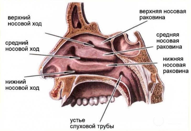 Лечение полипозного синусита