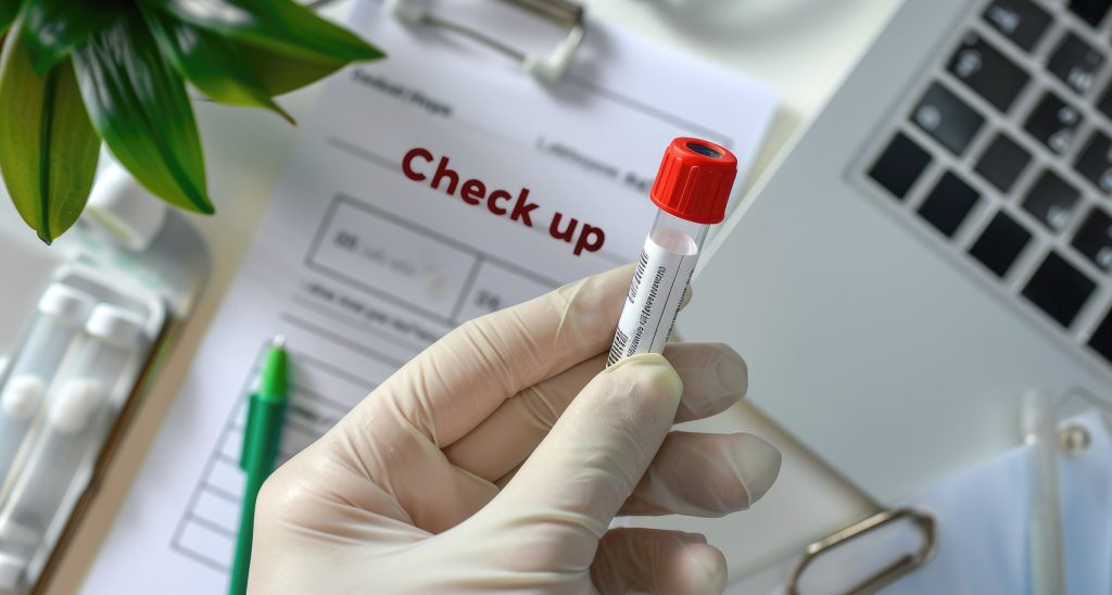 2400-ai-generated-doctor-holding-blood-tube-test